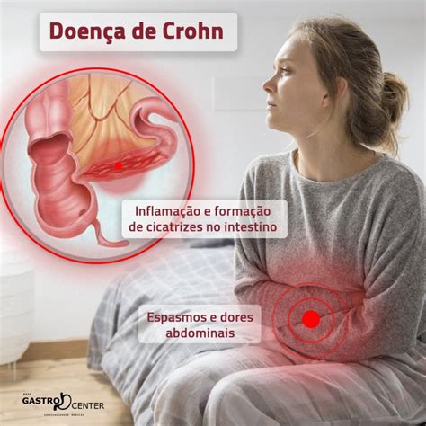 sintomas de doença de crohn-4